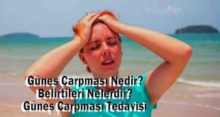 Güneş Çarpması Nedir? Belirtileri Nelerdir? Güneş Çarpması Tedavisi